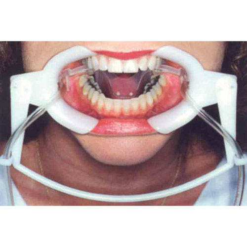 Nola Dry Field Tongue Guards Large White Ea thumbnail 7