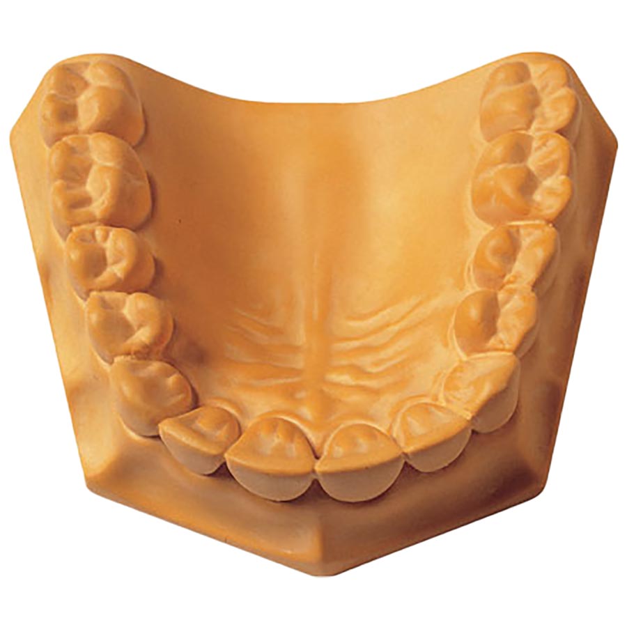 Prima Rock Yellow 33lb/15kg thumbnail 4