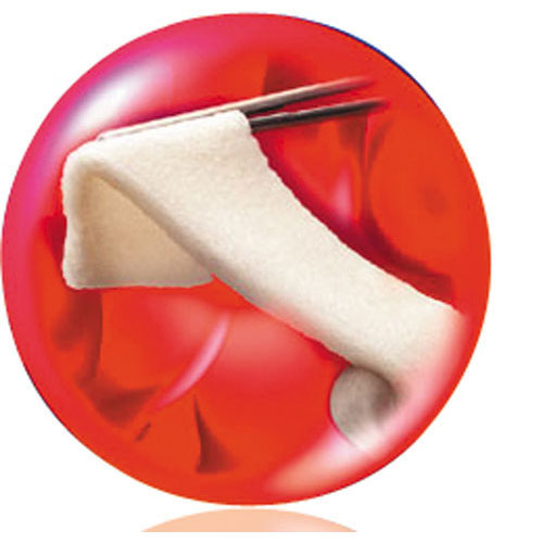 Surgifoam Gelatin Sponge, 24/Pk, 1969 thumbnail 9