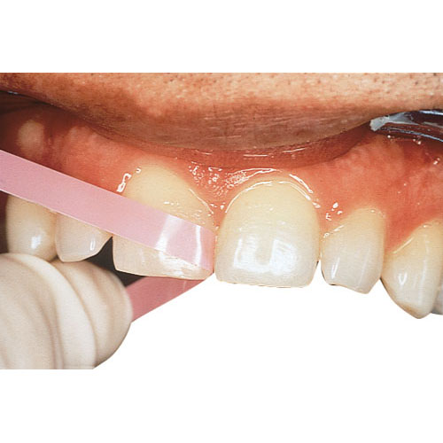 Super-Snap Polystrips, Coarse/Medium, Black/Violet, 100/Pk, L525 thumbnail 7