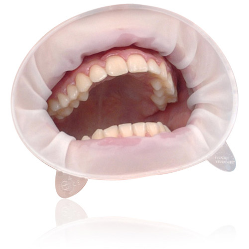 OptraGate 3D Lip & Cheek Retractor Junior White 80/Bx thumbnail 9